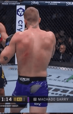 UFC fighter Garry Machado with a back injury during a fight.