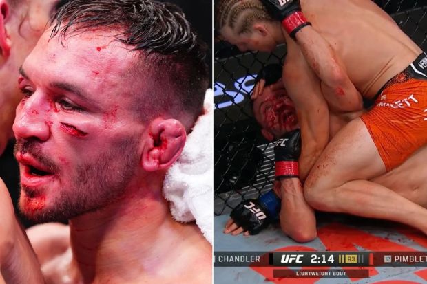 An image collage containing 1 images, Image 1 shows An image collage containing 2 images, Image 1 shows Michael Chandler with blood on his face after a TKO loss, Image 2 shows A bloody UFC fight; one fighter is on top of the other