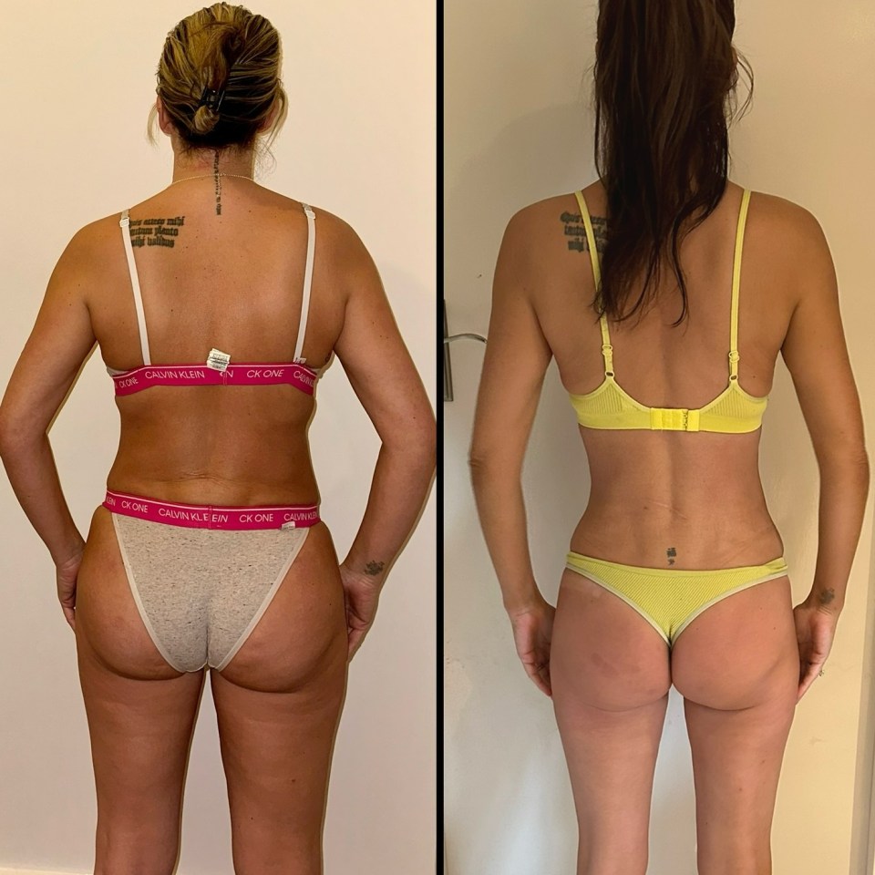 Before and after photos showing a woman's weight loss.